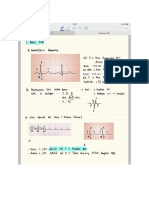 Ekg