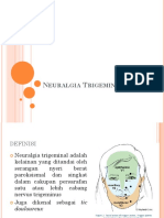 Neuralgia Trigeminal