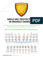 Smile Arc Protection Part 2