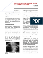 Tracheostomy 