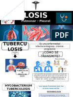 Tuberculosis