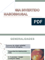 Papiloma Invertido Nasosinusal 1