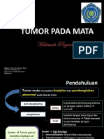 Tumor Mata Unismuh