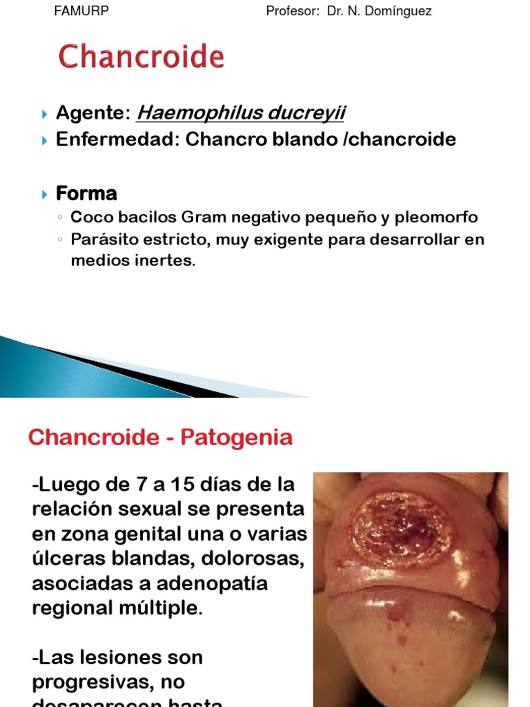 3 - H. Ducreyi | PDF
