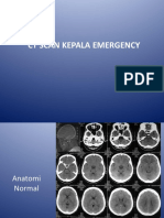 CT Scan Kepala Emergency