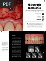 Microcirugia Endodóntica