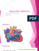 ablacion cardiaca