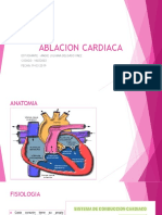 Ablacion Cardiaca