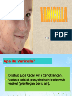 Varicella PDF