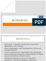 Retinopati