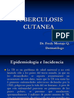 Tuberculosis cutanea