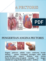 Ppt Angina