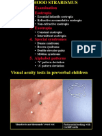 51childhood Strabismus