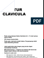 Fraktur Clavicula