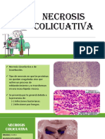 Patologia Expo Necrosis Colicuativa