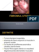 Fibromul Uterin