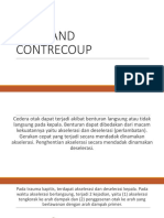 Coup and Contrecoup