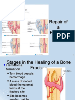 Bone Healing