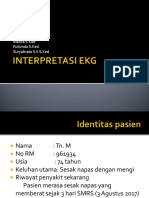 Interpretasi Ekg