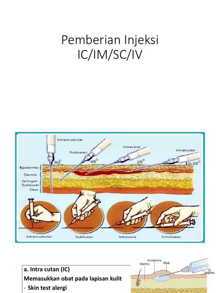 Lokasi dan Jenis Injeksi Obat | PDF | Kesehatan Holistik