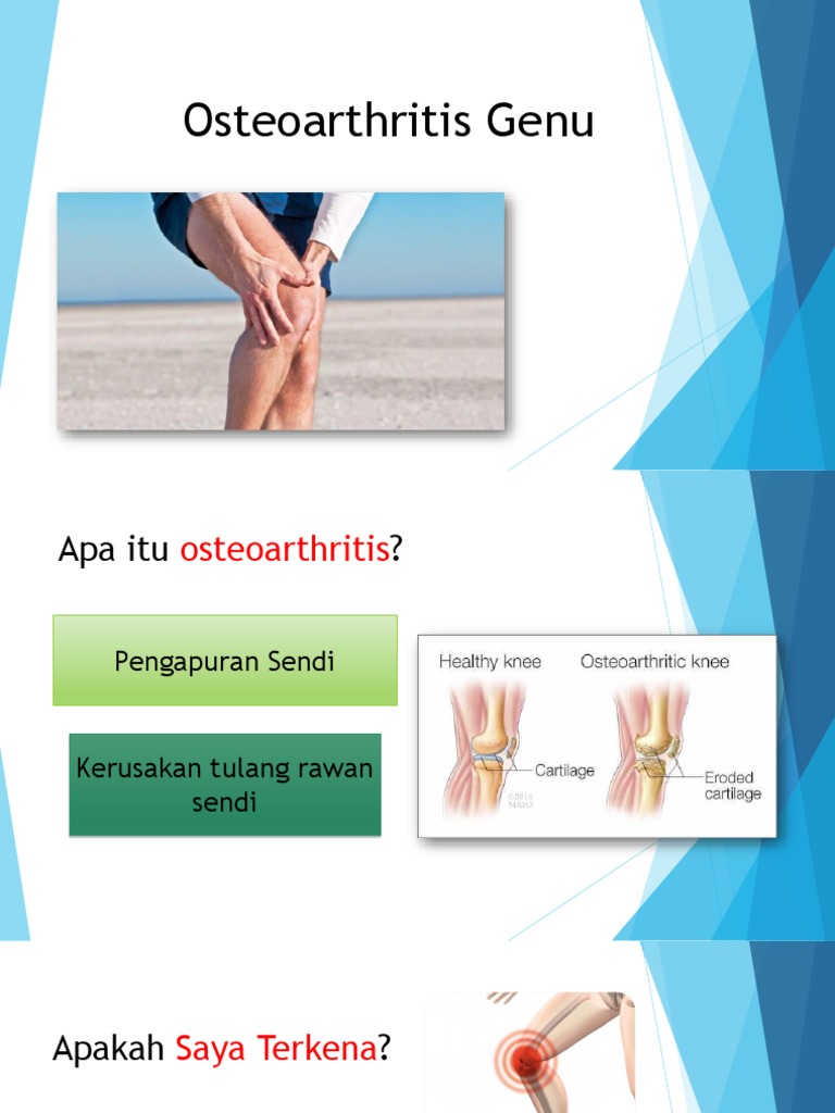Panduan Osteoarthritis Genu dan Penanganannya | PDF