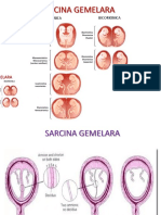 Curs Sarcina Gemelara