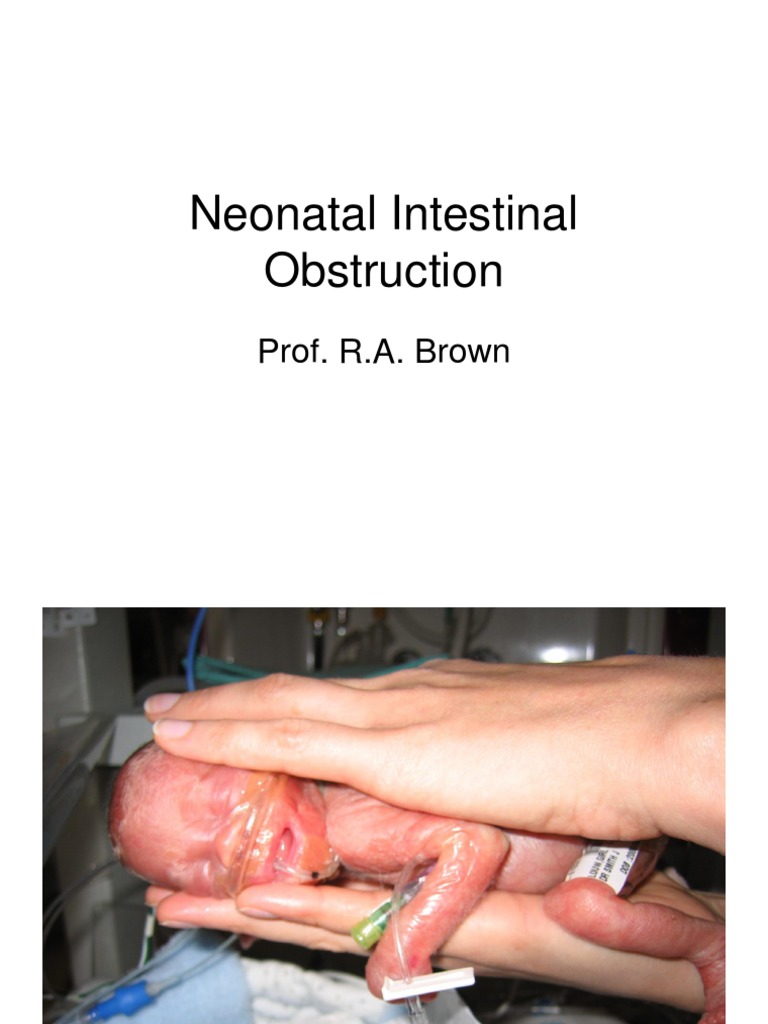 Neonatal Intestinal Obstruction Overview | PDF | Digestive System ...