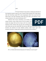 148954730-referat-Growing-Skull-Fracture-docx.docx