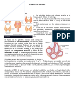 Cáncer de tiroides: Factores de riesgo, anatomía y epidemiología