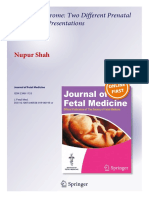 Joubert Syndrome Prenatal Presentations