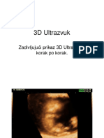 3D Ultrazvuk - Pps