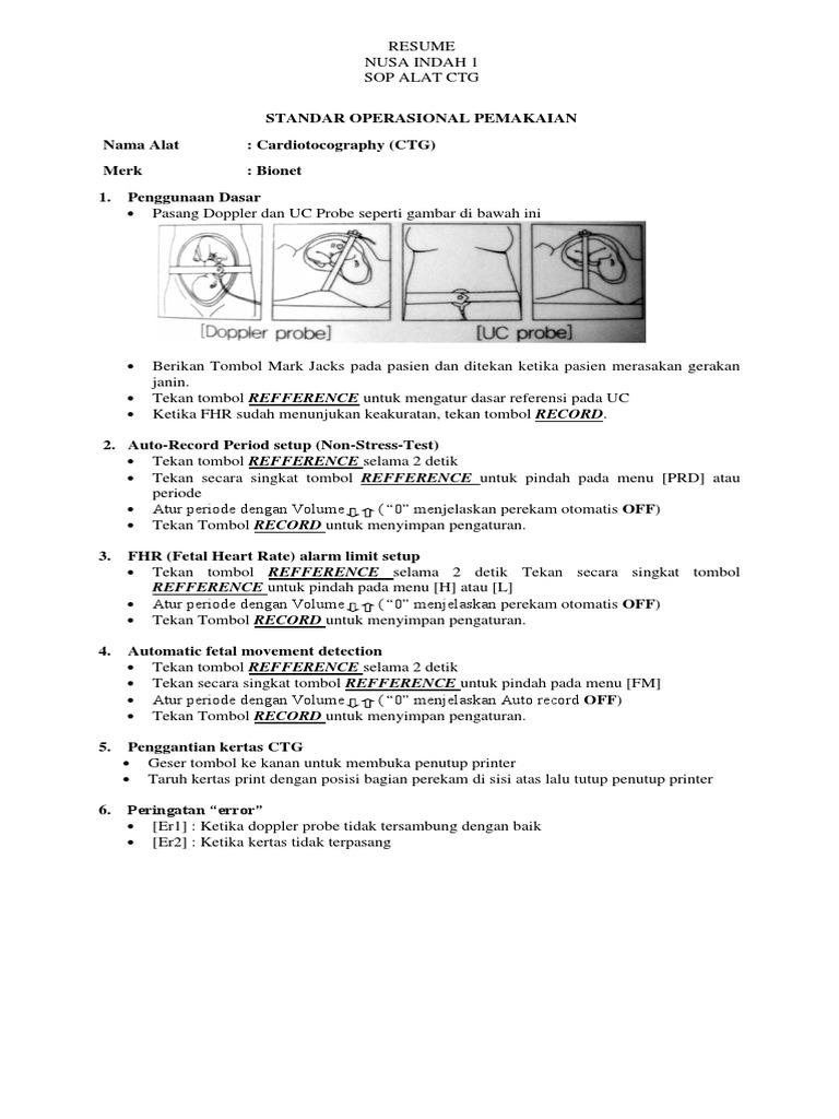 Sop CTG | PDF