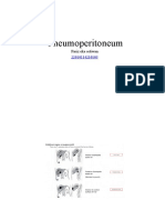 Pneumoperitoneum signs under 40 characters