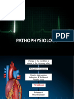 Pathophysiology Mi