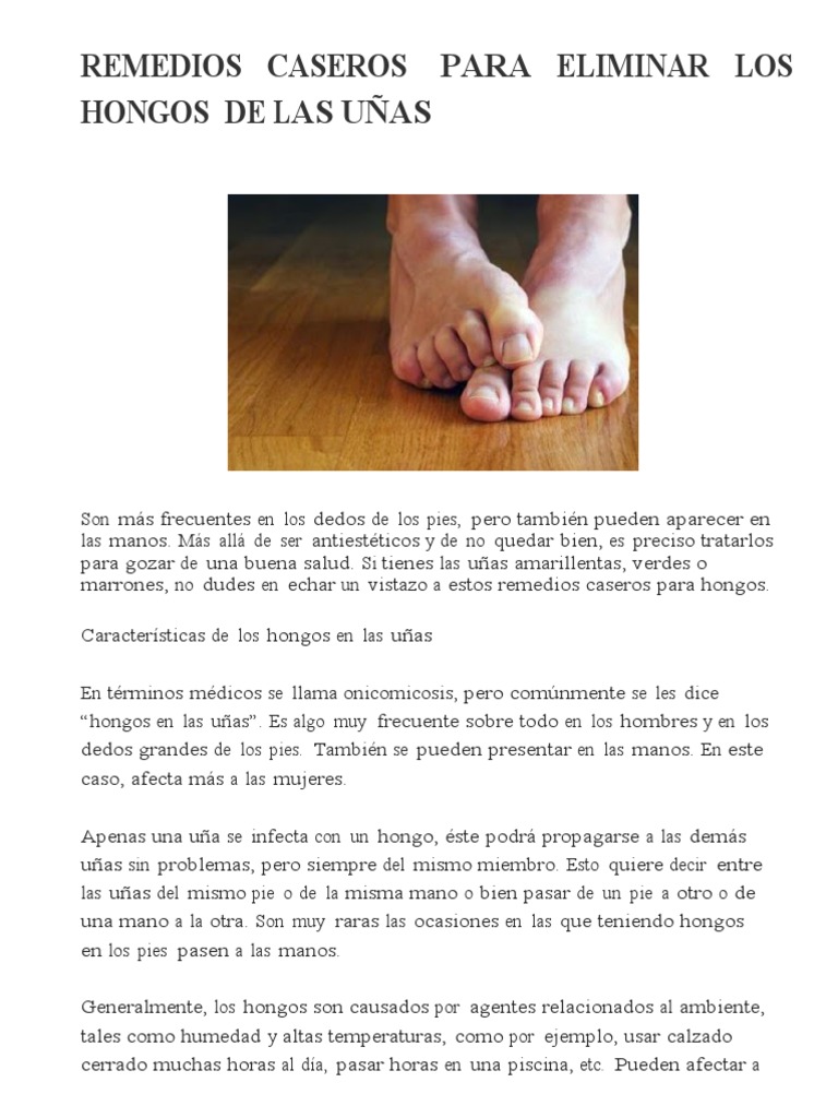Remedios Caseros para Eliminar Los Hongos de Las Uñas | PDF | Clavo  (anatomía) | Hongo