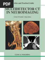 Evelyn M. Teasdale, Susan Aitken-Multidetector CT in Neuroimaging - An Atlas and Practical Guide-Clinical Publishing Services (2009) PDF