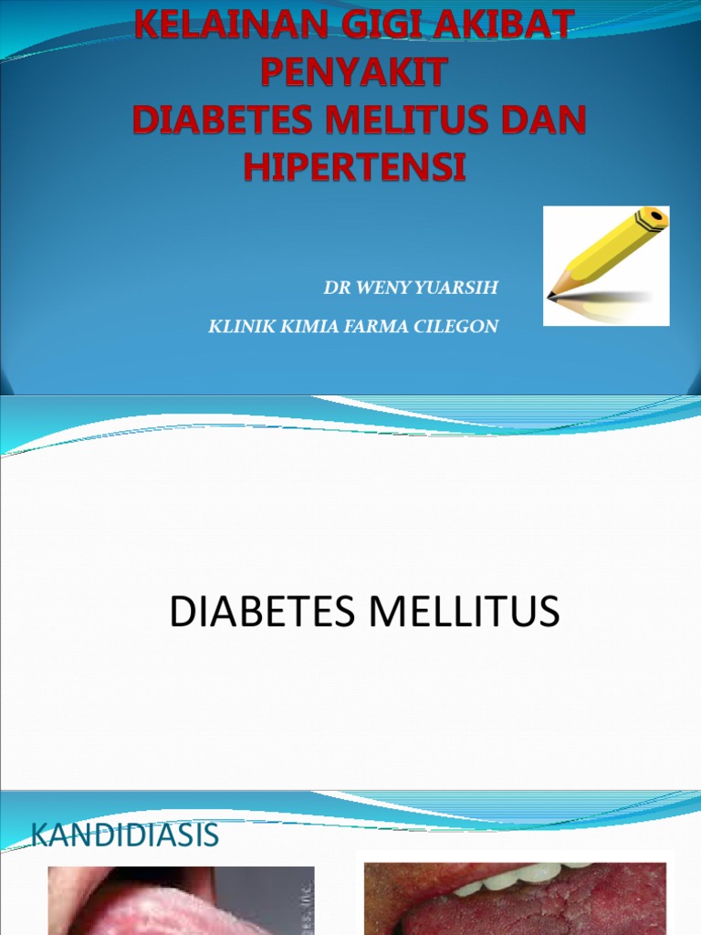Kelainan Gigi Akibat DM Dan HT | PDF