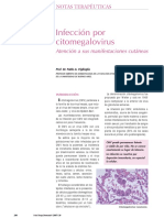 cmv infeccion.pdf