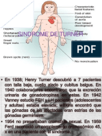 Sindrome de Turner