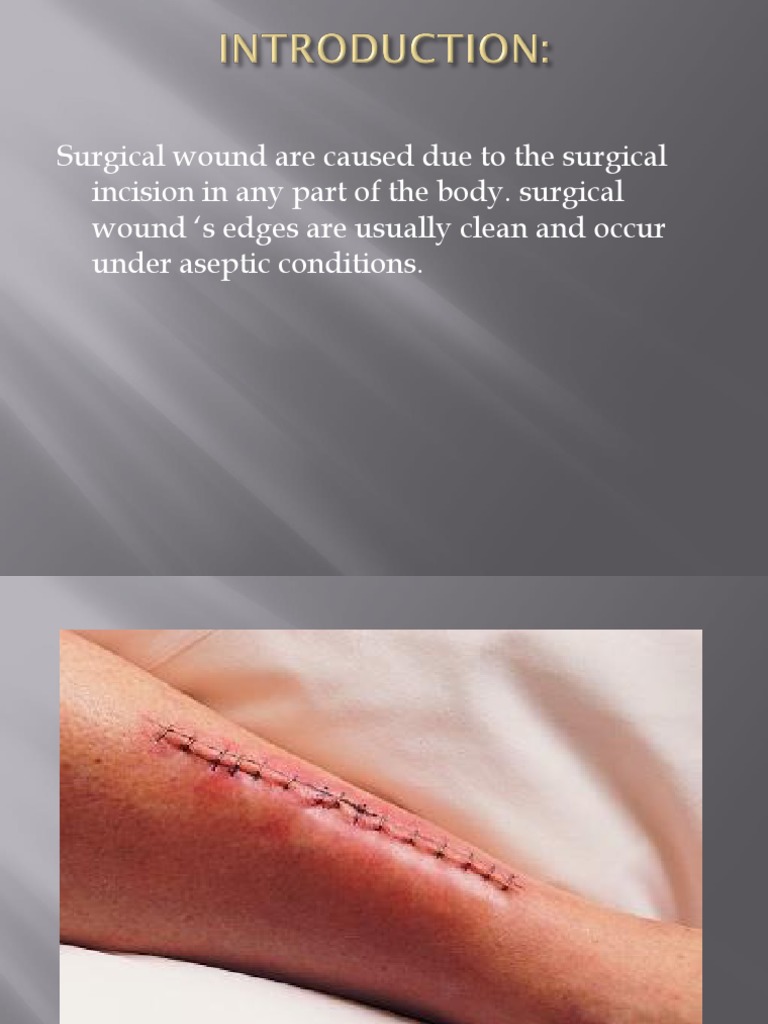 A Comprehensive Guide to Wound Dressing Procedures Best Practices