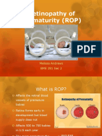 Retinopathy of Prematurity (ROP) : Melissa Andrews BME 281 Sec 2