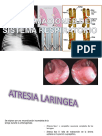 Malformaciones del sistema respiratorio