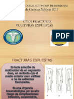 Open Fractures