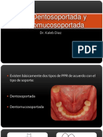 Clase 3 Diferencia Entre La Prtesis Parcial Removible Dentosoportada