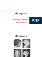 Mikrognatia