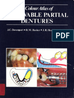 A Colour Atlas of Removable Partial Dentures - J. Davenport, et. al., (Wolfe Medical Pubs.) WW.pdf