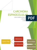 Cancer Espinocelular