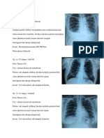 Tugas Radiologi Rayadi 26 Januari 2019