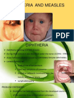 Diphtheria and Measles
