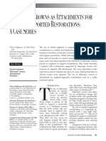 Telescopic Crowns as Attachments for Implant Supported Restorations A Case Series.pdf